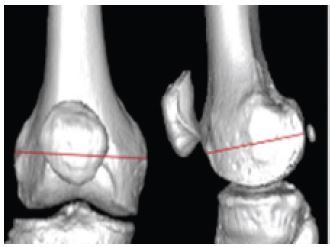Fig. 12 Fig. 12