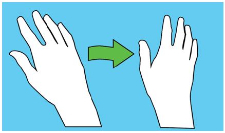 Figure 3 Figure 3
