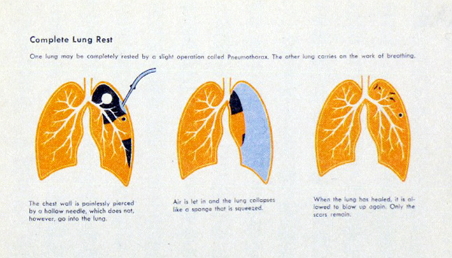 Figure 11 Figure 11